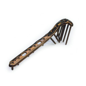 tibia compression plate 1