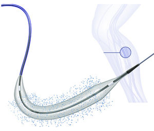 PTA catheter