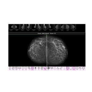 mammography software