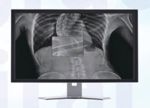 radiology software