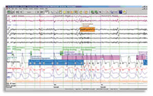 polysomnography software