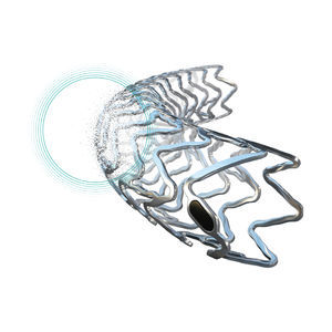 coronary stent