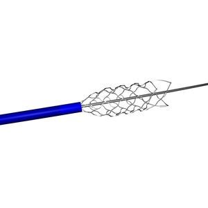 titanium stent 1