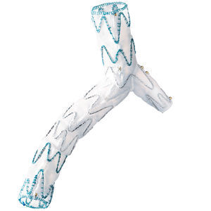 iliac artery stent graft