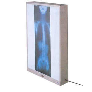 1-screen X-ray film viewer 1