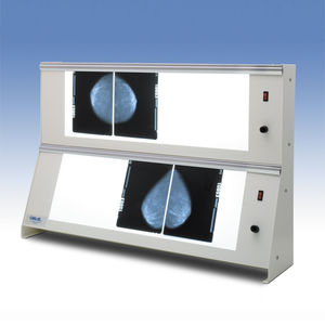 2-screen X-ray film viewer