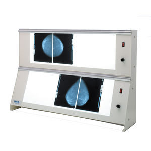 2-screen X-ray film viewer