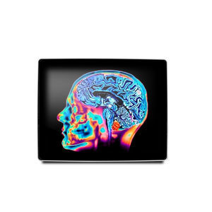 medical display 1