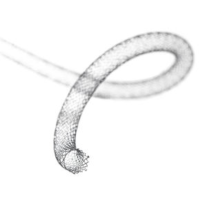 peripheral stent