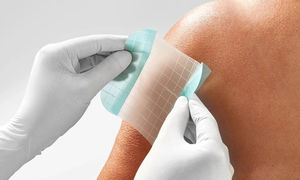 transparent wound dressing 1