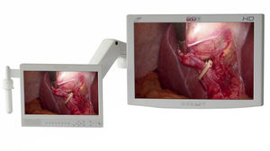 endoscopy display