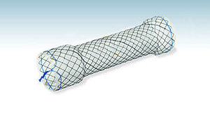 colorectal stent