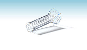 duodenal stent