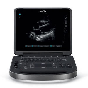 portable ultrasound system