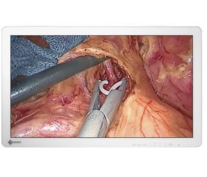 endoscopy display 1