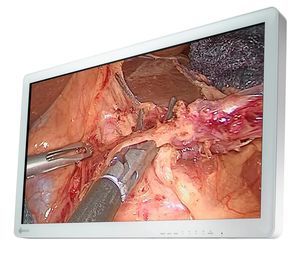 OR display