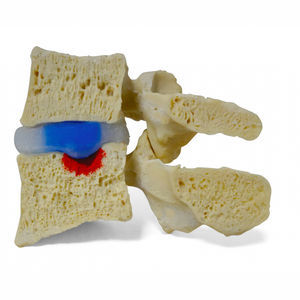 intervetebral disc model