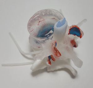 intervetebral disc model
