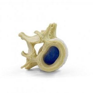 vertebra anatomical model
