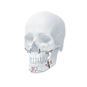 mandible compression plate
