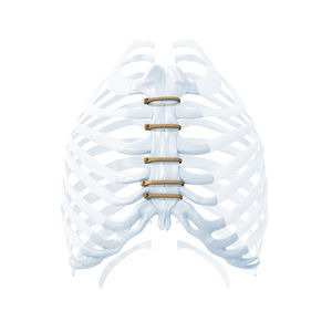 sternal closure bone cerclage wiring