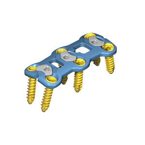 cervical compression plate