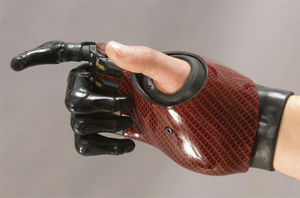 myo-electric partial hand prosthesis