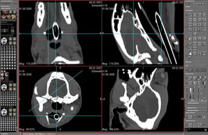 CT software