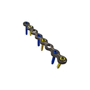 hand phalange compression plate