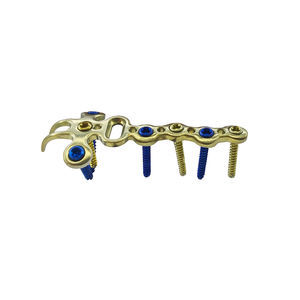 hand phalange compression plate
