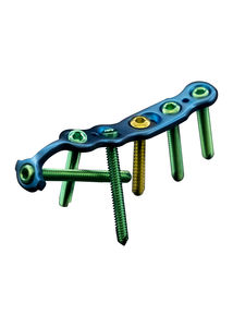 tibia compression plate