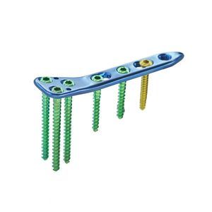 tibia osteotomy plate 1