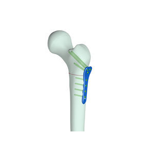 patella model