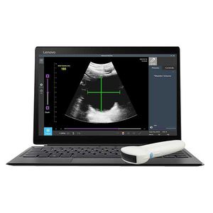 hand-held ultrasound system