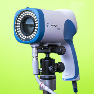 video colposcope