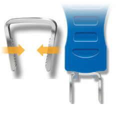 forefoot bone staple / non-absorbable