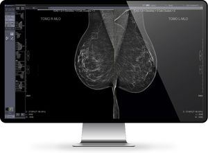 medical imaging PACS 1