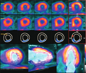 SPECT software - MIM Encore™ - MIM Software - cardiac / PET / for ...