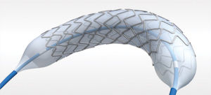 coronary stent