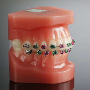 ligature orthodontic elastic 1