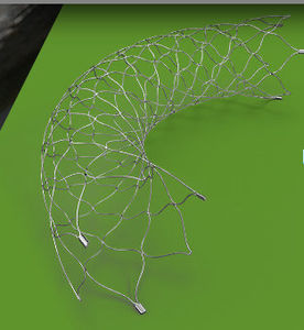 intracranial stent