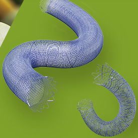 intracranial stent