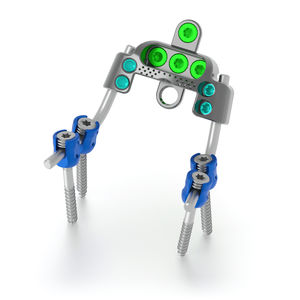 occipito-cervico-thoracic osteosynthesis unit 1