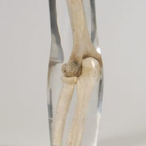 radiography test phantom 1
