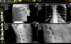 medical imaging transmission system