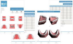 orthodontic software