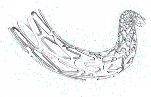coronary stent