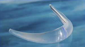 chin implant