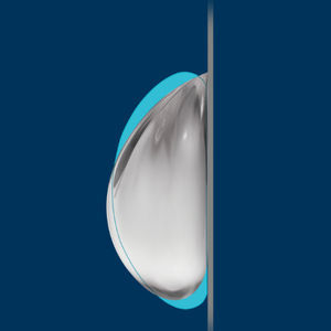 breast implant 1