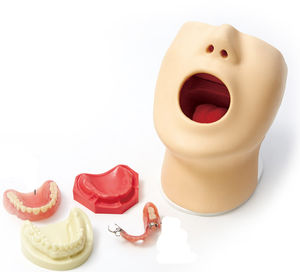 denture model